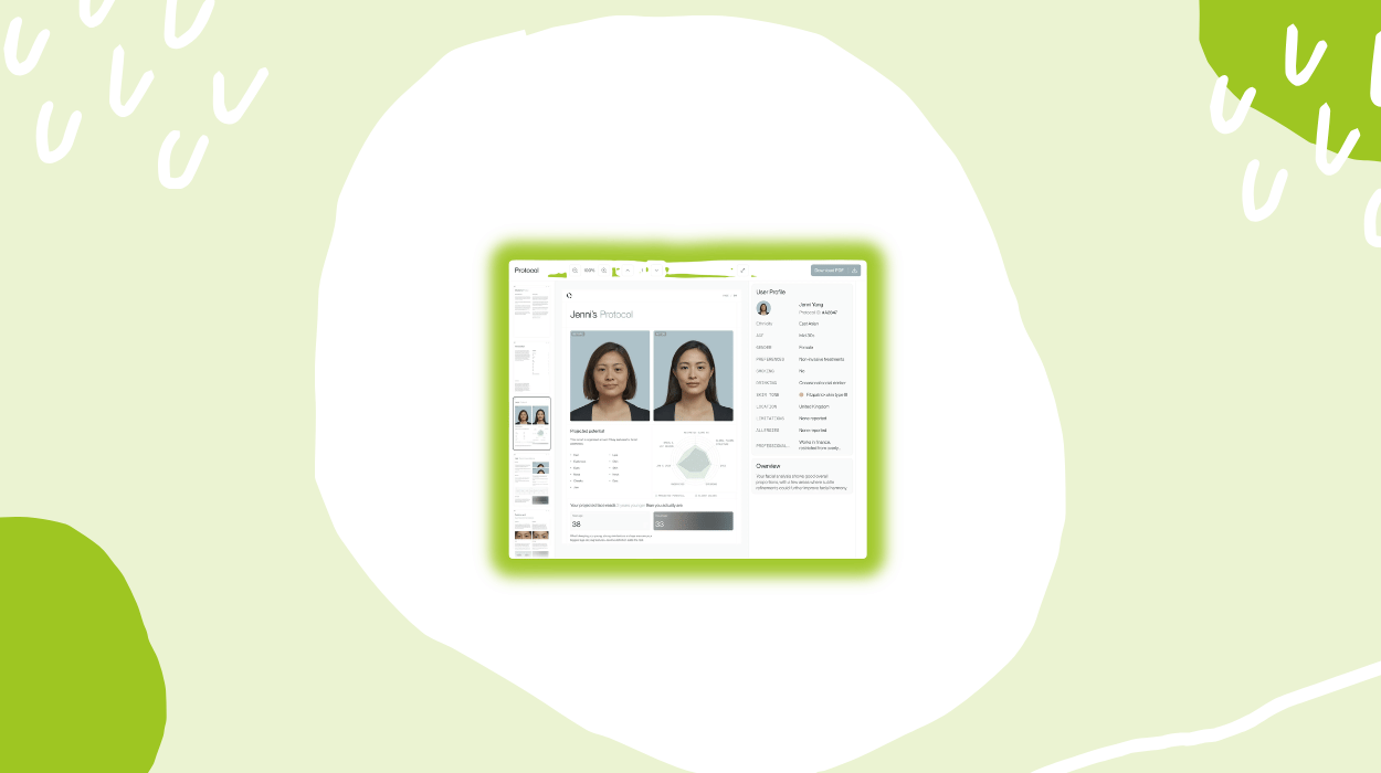 Qoves Review